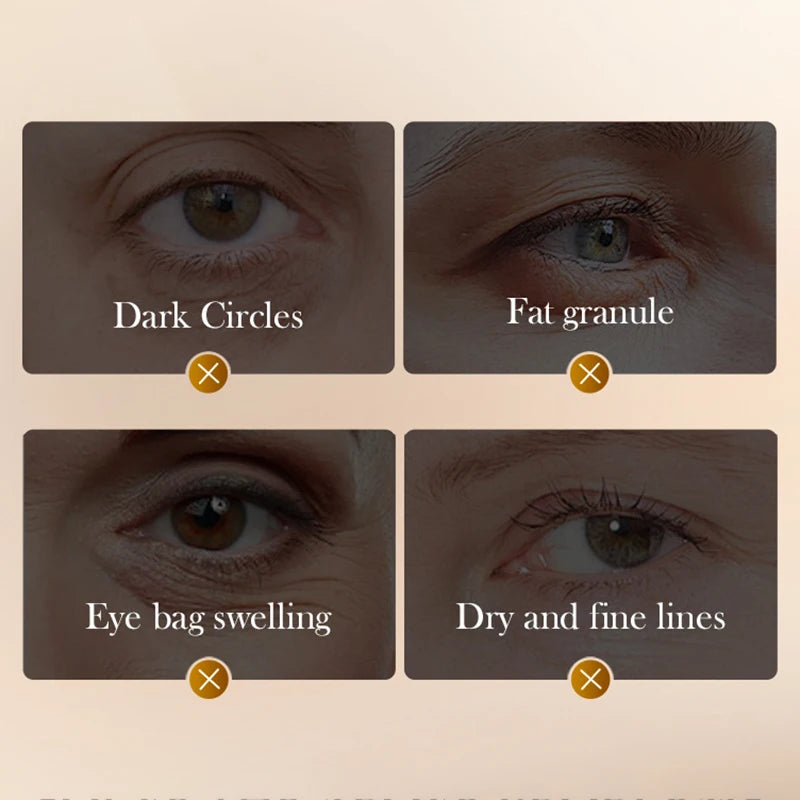 Crema de masaje para el contorno de ojos con péptidos de veneno de serpiente y cafeína de SADOER, antiarrugas, antiojeras, antienvejecimiento e hidratante para el cuidado de la piel del contorno de ojos.