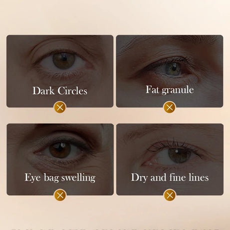 Crème contour des yeux SADOER à base de venin de serpent, de peptides et de caféine, anti-rides, massante, anti-cernes et hydratante. Soin anti-âge pour les yeux.