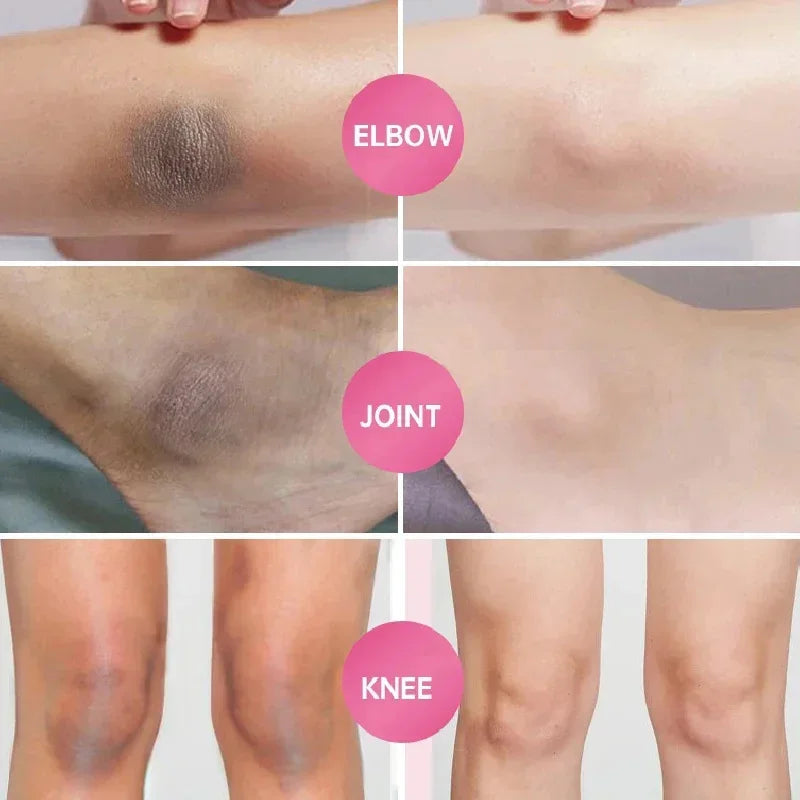 Crème éclaircissante pour peaux foncées, aisselles, cuisses, articulations internes, zone intime, soin du corps, lotion éclaircissante pour parties intimes