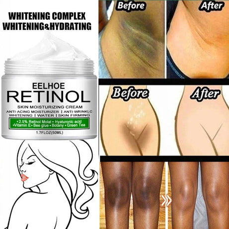 Crema blanqueadora corporal para partes íntimas, suero blanqueador para axilas, blanquea glúteos, rodillas, ilumina la parte interna del muslo, piel oscura íntima, elimina la melanina.