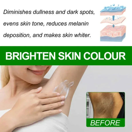 Body Whitening Cream Dark Skin Armpit Lightening Intimate Areas Underarm Bleaching Private Parts Whiten Cream Body Lotion Beauty