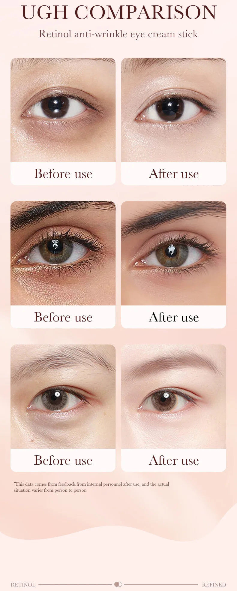 Crema de contorno de ojos con retinol en barra para eliminar ojeras, hidratar, reafirmar e iluminar la piel del contorno de ojos.