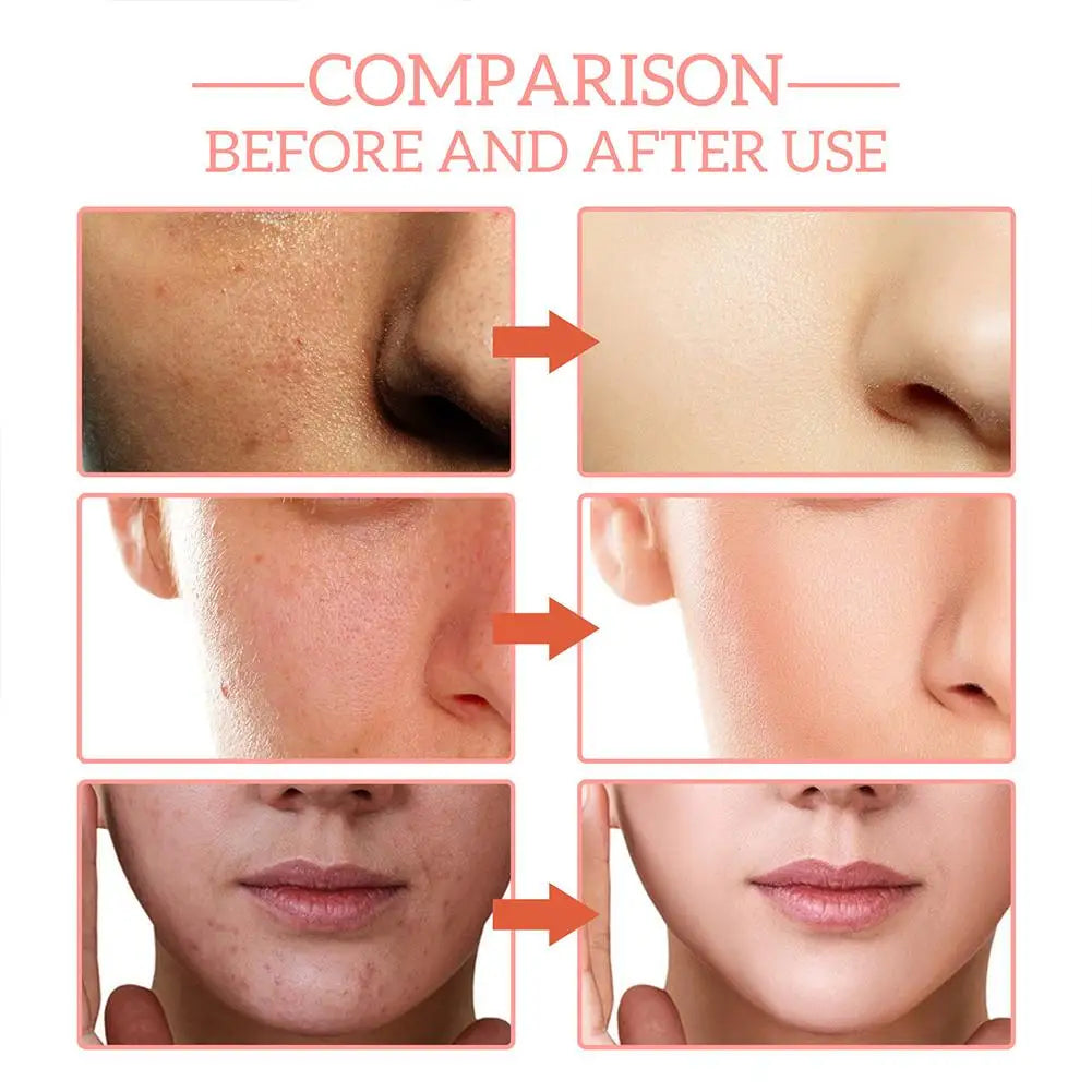 Sérum visage 5 en 1 : Atténue les ridules, raffermit, hydrate et illumine le teint, enrichi en vitamine C et en acide hyaluronique, resserre les pores. Soin de la peau.