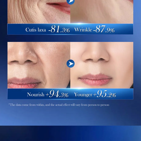 Crème anti-rides instantanée au rétinol pour le visage : soin anti-âge raffermissant et liftant, atténue les ridules, améliore l’apparence de la peau, hydrate et illumine le teint.