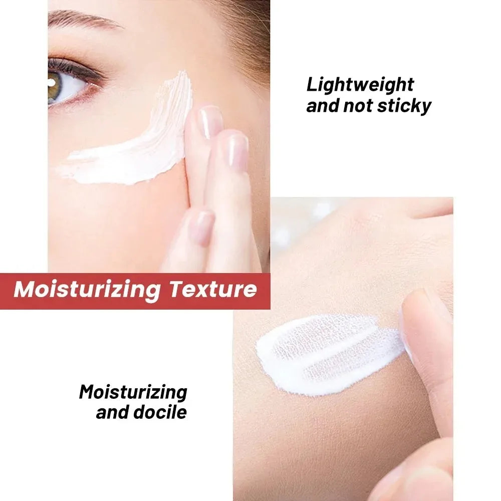 1/3/5pcs Whitening Freckle Cream Niacinamide Remove Dark Spot Cream Anti Freckle and Aging Cream Fade Pigmentation Melasma Skin