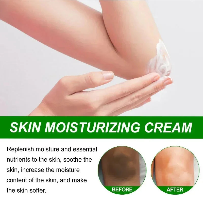 Body Whitening Cream Dark Skin Armpit Lightening Intimate Areas Underarm Bleaching Private Parts Whiten Cream Body Lotion Beauty