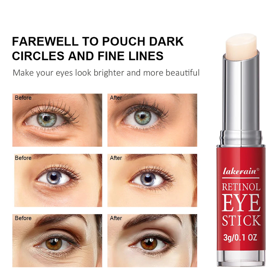 Crema de ojos con retinol para aclarar ojeras y reafirmar la piel. Sérum reparador instantáneo para el contorno de ojos para mujeres. Cuidado de los ojos femeninos.