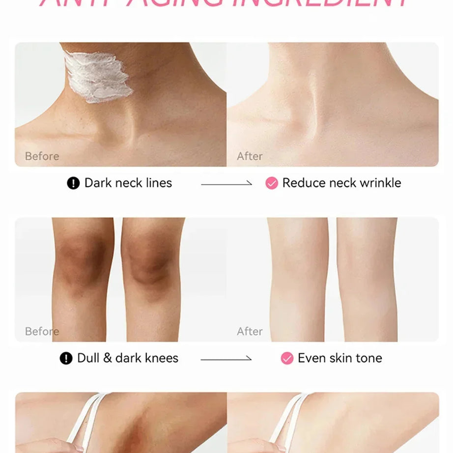 Crème éclaircissante pour peaux foncées, aisselles, cuisses, articulations internes, zone intime, soin du corps, lotion éclaircissante pour parties intimes