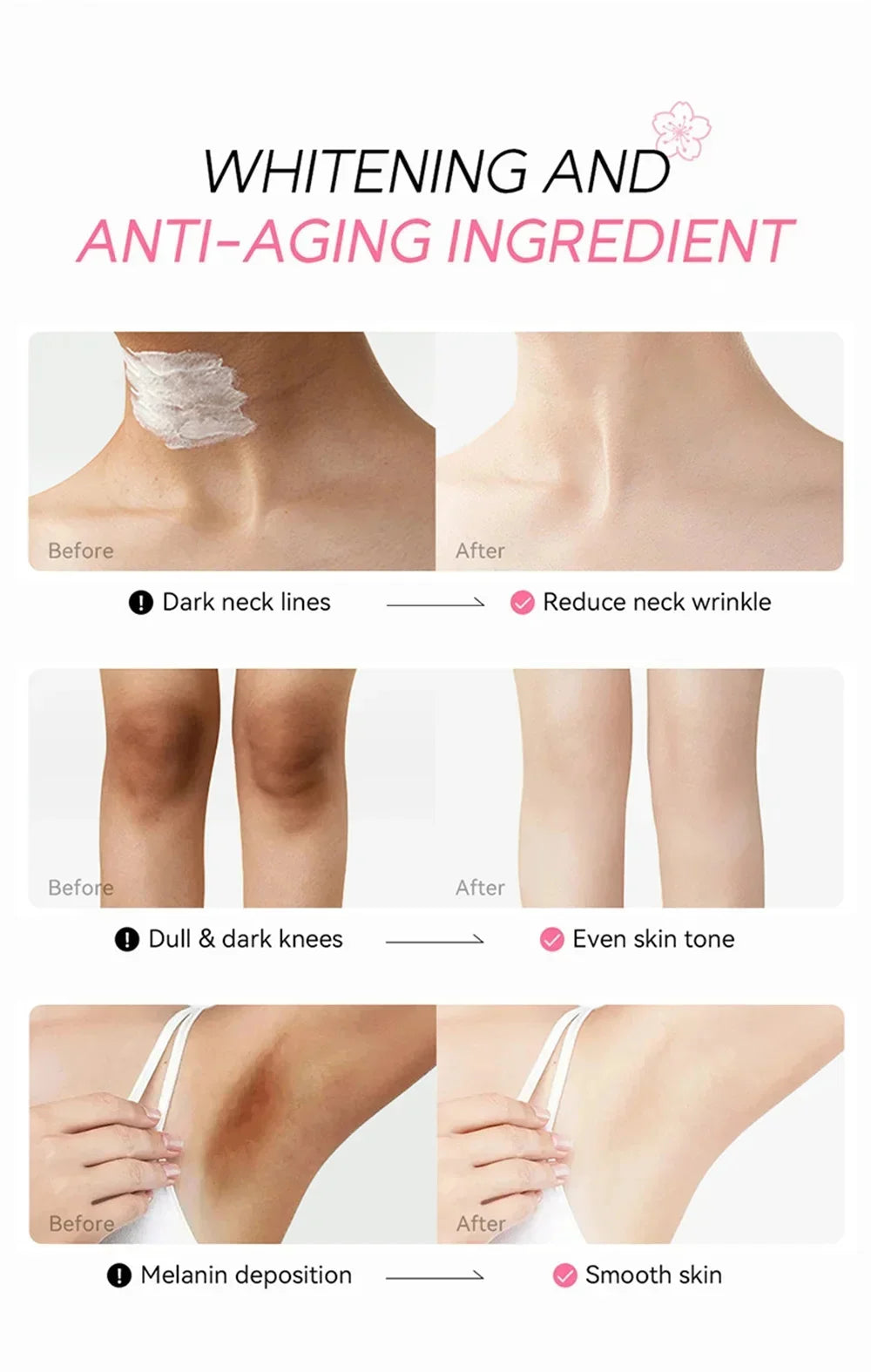 Crème éclaircissante pour peaux foncées, aisselles, cuisses, articulations internes, zone intime, soin du corps, lotion éclaircissante pour parties intimes