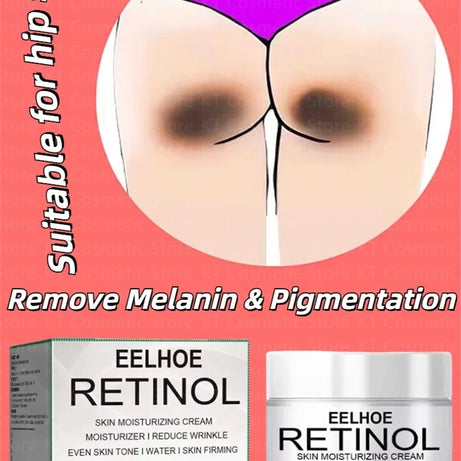 Body Whitening Cream Dark Skin Armpit Lightening Intimate Areas Underarm Bleaching Private Parts Whiten Cream Body Lotion Beauty