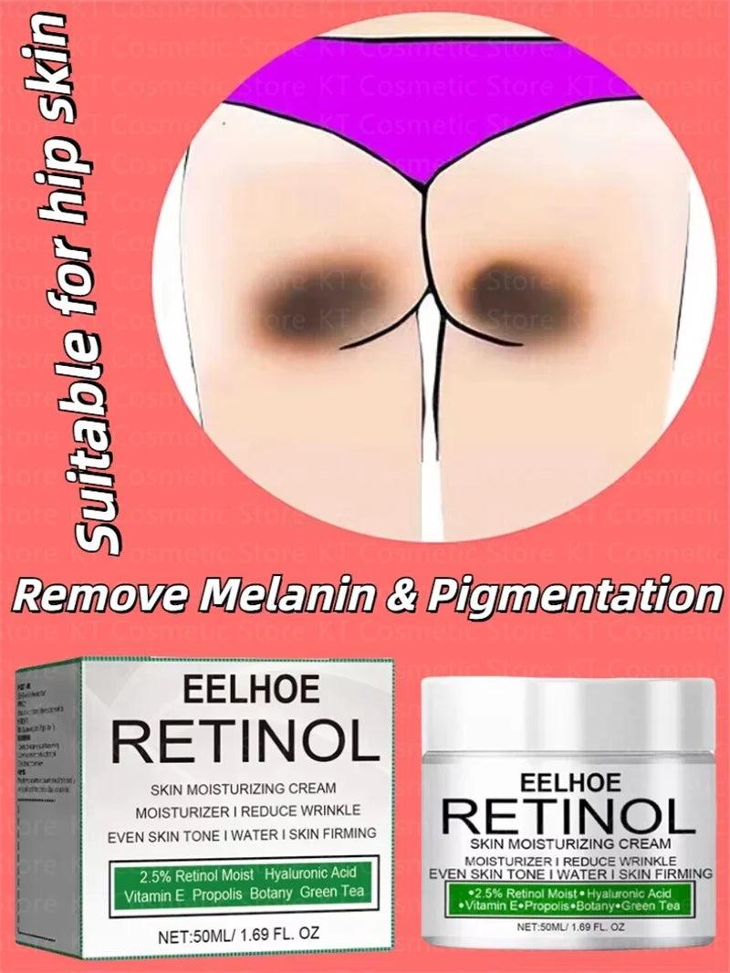 Body Whitening Cream Dark Skin Armpit Lightening Intimate Areas Underarm Bleaching Private Parts Whiten Cream Body Lotion Beauty