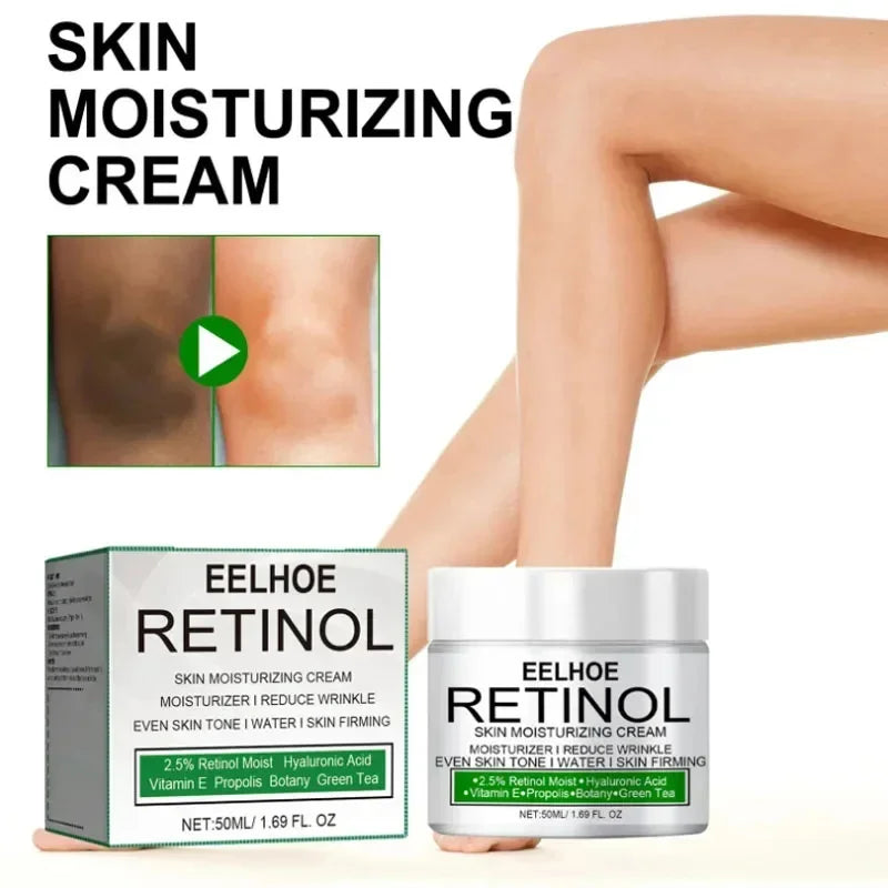 Body Whitening Cream Dark Skin Armpit Lightening Intimate Areas Underarm Bleaching Private Parts Whiten Cream Body Lotion Beauty