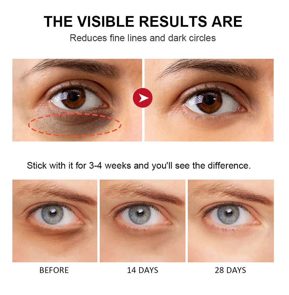 Crema de ojos con retinol para aclarar ojeras y reafirmar la piel. Sérum reparador instantáneo para el contorno de ojos para mujeres. Cuidado de los ojos femeninos.