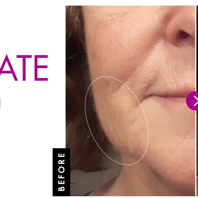 50g Collagen Face Cream Nourish Plump Up Skin,fresh Texture Cream Make Skin Younger Day/Night Cream Moisturizer Korean Cosmetics