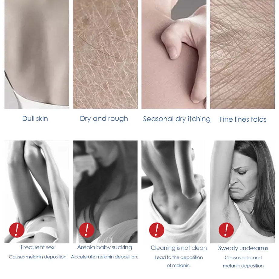 Crema blanqueadora corporal para partes íntimas, suero blanqueador para axilas, blanquea glúteos, rodillas, ilumina la parte interna del muslo, piel oscura íntima, elimina la melanina.