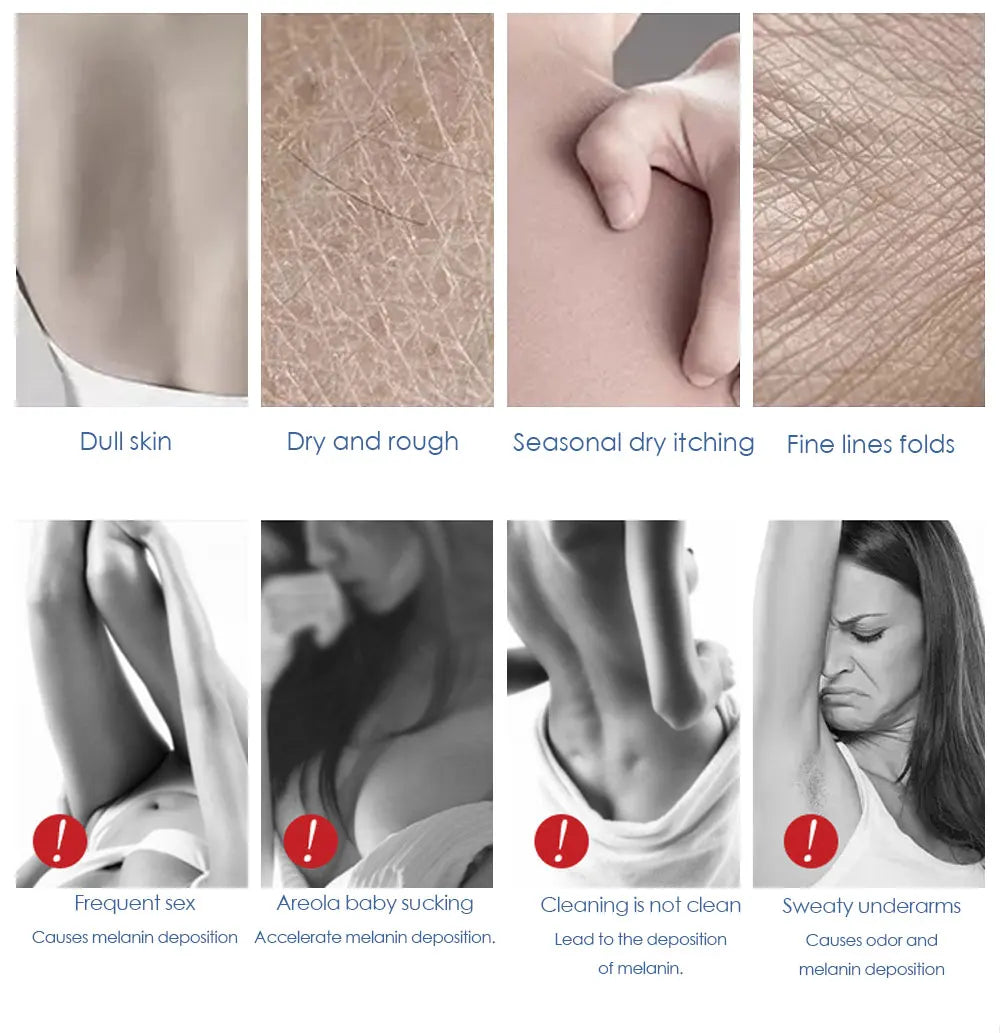 Crema blanqueadora corporal para partes íntimas, suero blanqueador para axilas, blanquea glúteos, rodillas, ilumina la parte interna del muslo, piel oscura íntima, elimina la melanina.