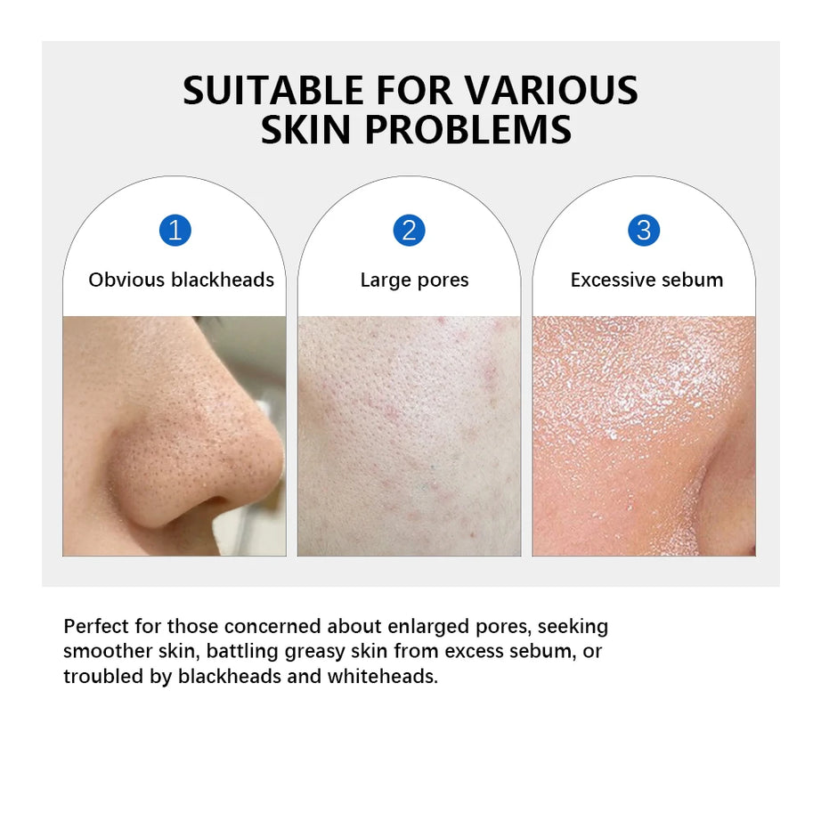 Disques toniques visage Zero Pore Pad 2.0 à double texture pour exfolier et lisser les pores. Soin coréen pour tous types de peau. 70 disques.