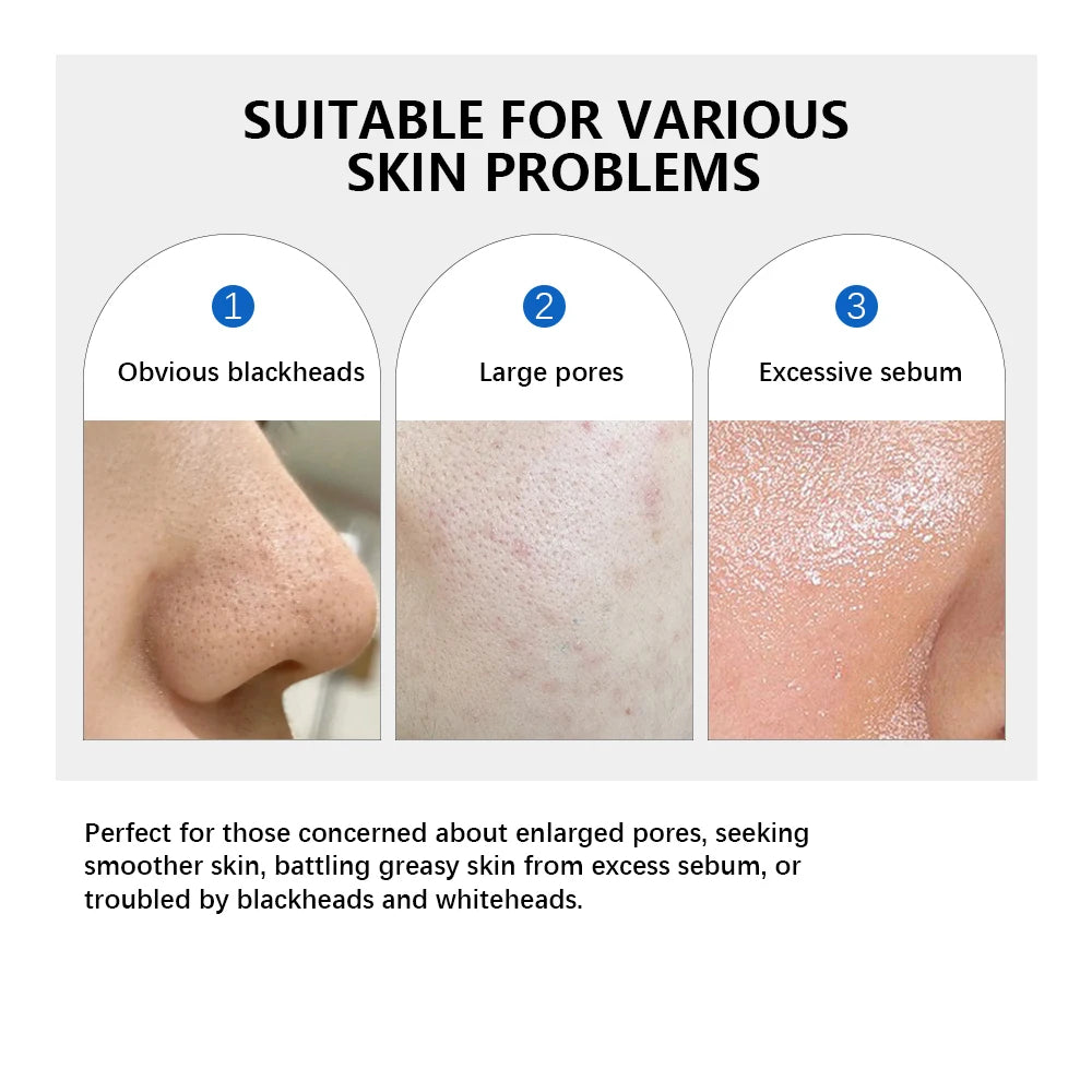 Disques toniques visage Zero Pore Pad 2.0 à double texture pour exfolier et lisser les pores. Soin coréen pour tous types de peau. 70 disques.
