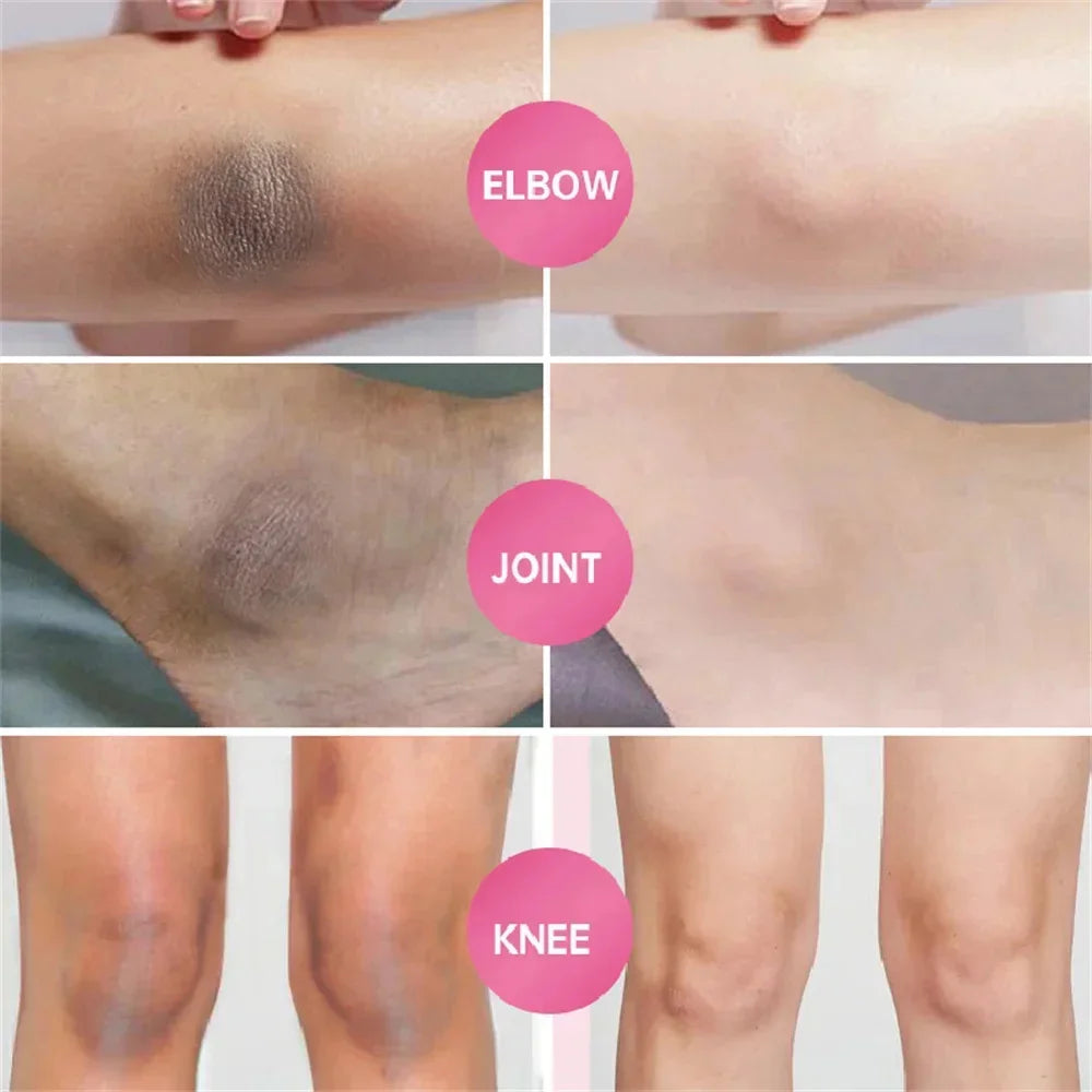 Crème éclaircissante pour peaux foncées, aisselles, cuisses, articulations internes, zone intime, soin du corps, lotion éclaircissante pour parties intimes