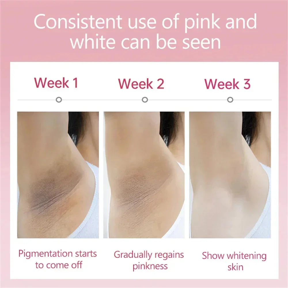 Crème éclaircissante pour peaux foncées, aisselles, cuisses, articulations internes, zone intime, soin du corps, lotion éclaircissante pour parties intimes