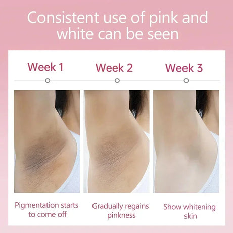 Crème éclaircissante pour peaux foncées, aisselles, cuisses, articulations internes, zone intime, soin du corps, lotion éclaircissante pour parties intimes