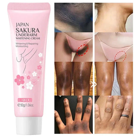 Crème éclaircissante pour peaux foncées, aisselles, cuisses, articulations internes, zone intime, soin du corps, lotion éclaircissante pour parties intimes
