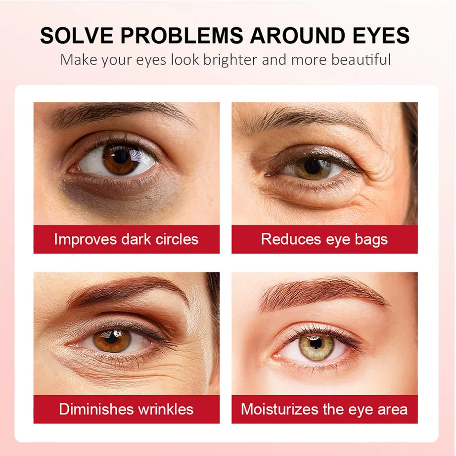 Crema de ojos con retinol para aclarar ojeras y reafirmar la piel. Sérum reparador instantáneo para el contorno de ojos para mujeres. Cuidado de los ojos femeninos.