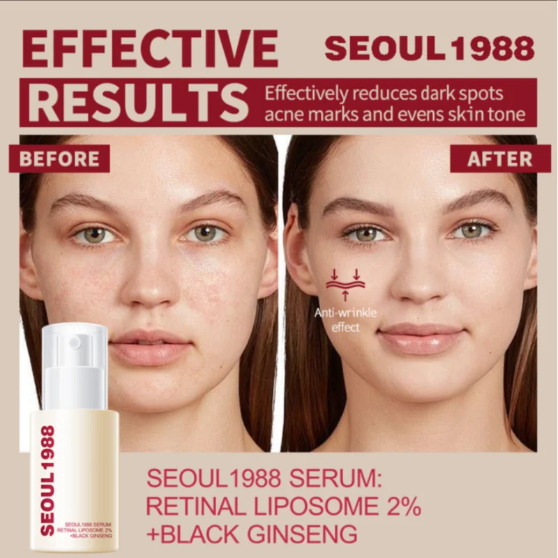 Women's Retinol Eye Cream Series Serum Lightening Dark Circles Lifting And Firming Skin Anti Aging Eye Repair Seoul 1988 Product