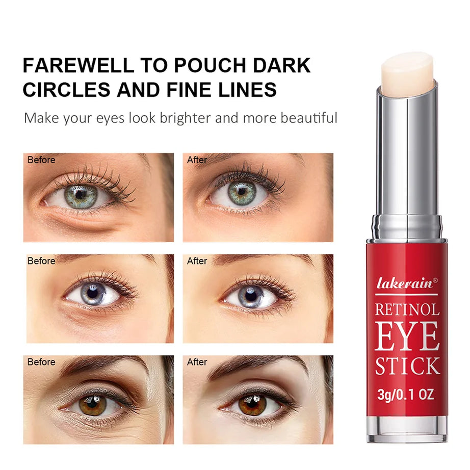 Crema de ojos con retinol para aclarar ojeras y reafirmar la piel. Sérum reparador instantáneo para el contorno de ojos para mujeres. Cuidado de los ojos femeninos.