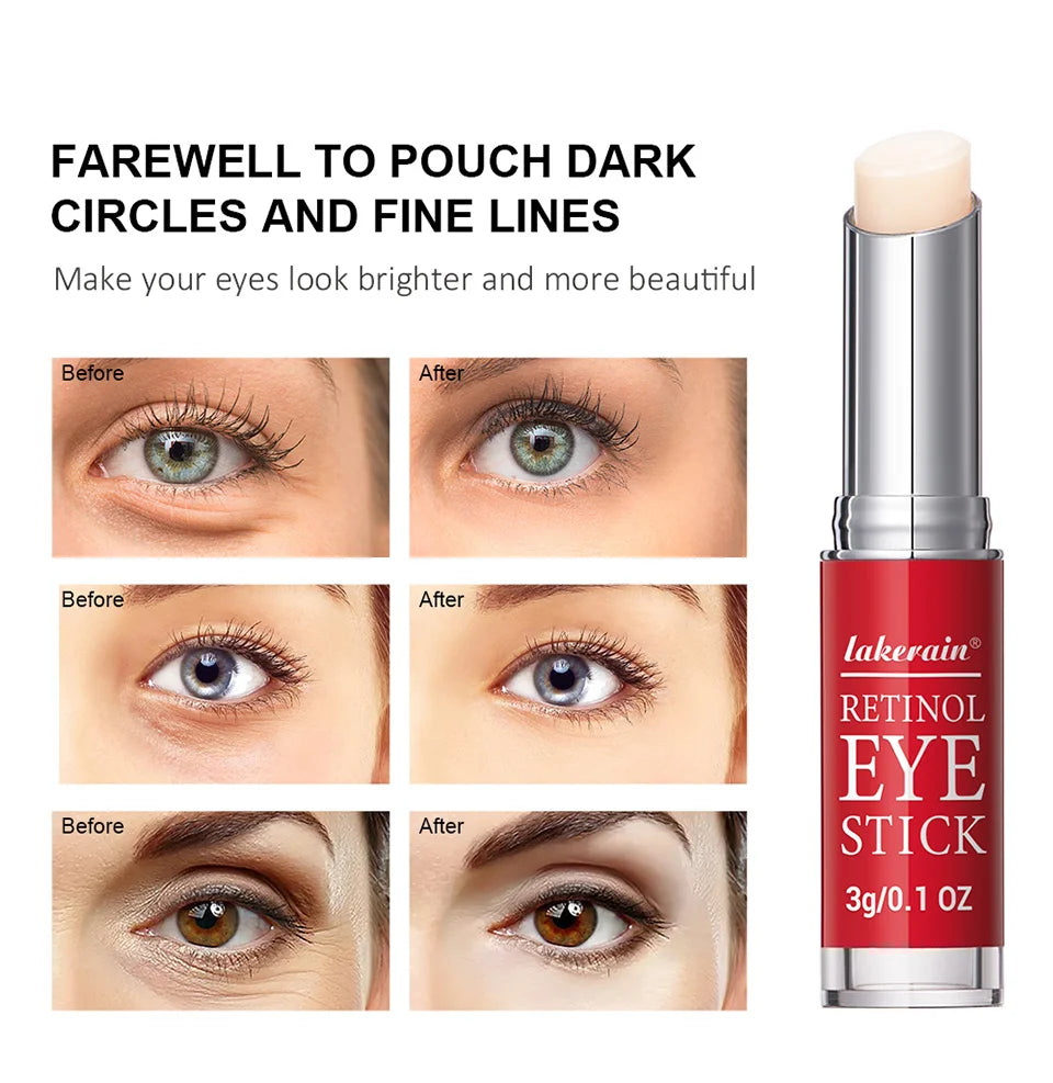 Crema de ojos con retinol para aclarar ojeras y reafirmar la piel. Sérum reparador instantáneo para el contorno de ojos para mujeres. Cuidado de los ojos femeninos.