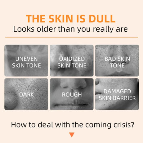 Orange Exfoliating Gel Dead Spot Remover Brighten Peeling 50g Gentle Repair Scrub Whiten Hydrating Moisturizer Korean Skin Care