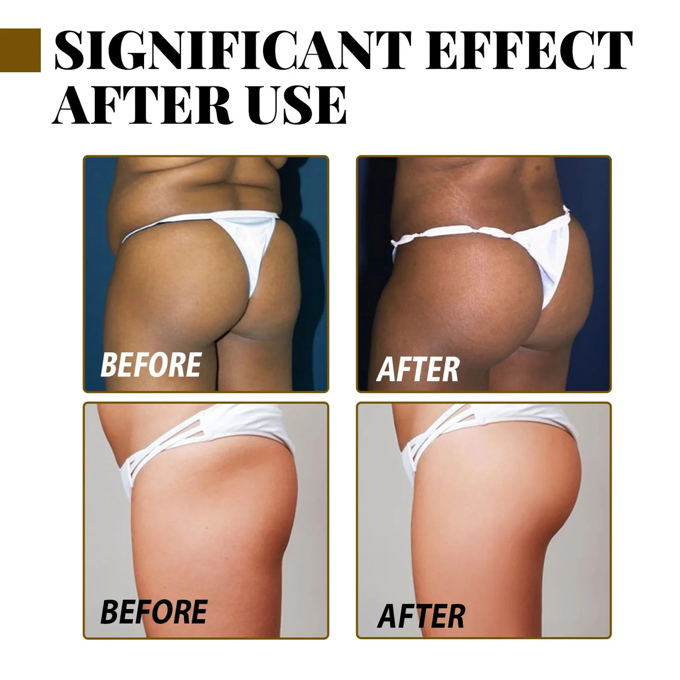 Huile essentielle pour augmenter le volume des fesses, rehausser les fesses, raffermir les hanches, repulper les seins, soins du corps sexy