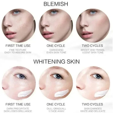 1/3/5pcs Whitening Freckle Cream Niacinamide Remove Dark Spot Cream Anti Freckle and Aging Cream Fade Pigmentation Melasma Skin