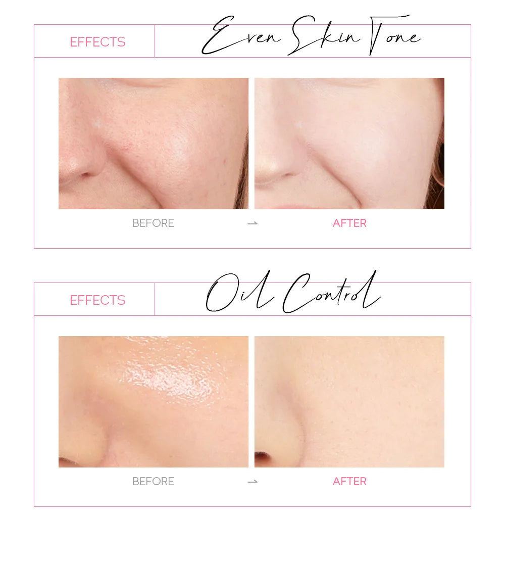Masque visage exfoliant à l'or 24 carats LAIKOU Sakura : anti-rides, blanchissant, éliminateur de points noirs, masque à déchirer, produits de soin de la peau