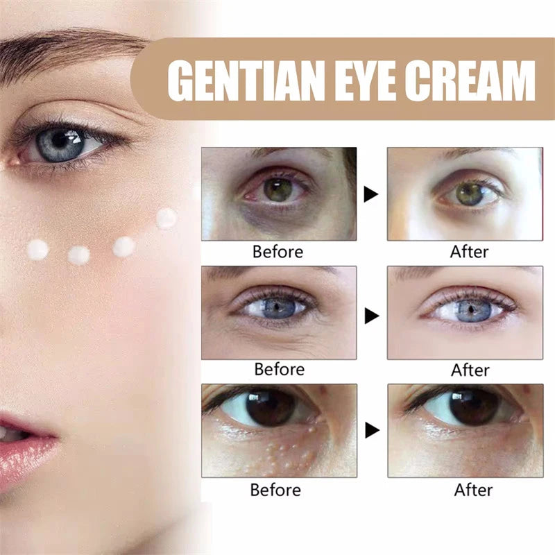 Women's Retinol Eye Cream Series Serum Lightening Dark Circles Lifting And Firming Skin Anti Aging Eye Repair Seoul 1988 Product